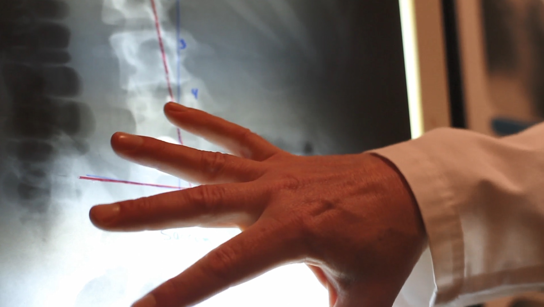 Digital X-rays